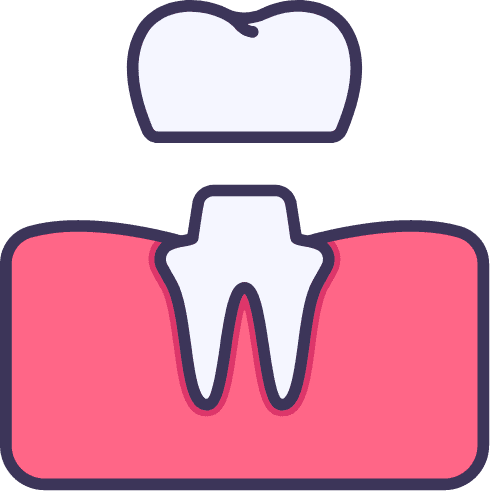dental-crown