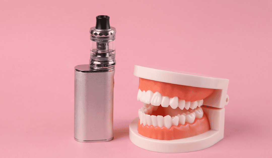 Can You Vape After Teeth Whitening?