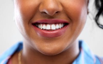Composite Bonding Deals: Affordable Smile Enhancements