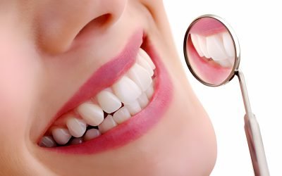 How Is Teeth Whitening Covered by Dental Insurance? Complete Guidence