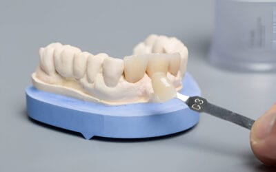 How Many Years Does a Zirconia Crown Last?