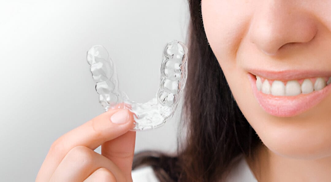 Invisalign