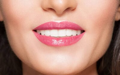 Are There Any Risks or Side Effects Associated with Teeth Whitening in Aberdeen?