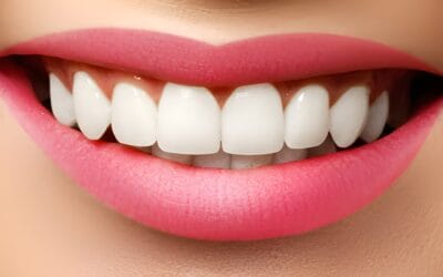 Can teeth whitening be done if I have dental fillings or crowns in Aberdeen?